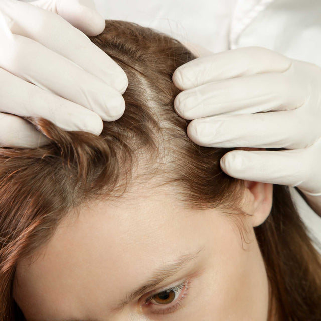 zoom-rosto-mulher-cabelo-alopecia-queda-cabelo-tratamento