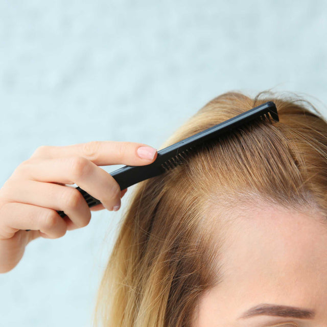 mulher-escovando-cabelo-falha-entrada-zoom-testa-cabelo-alopecia